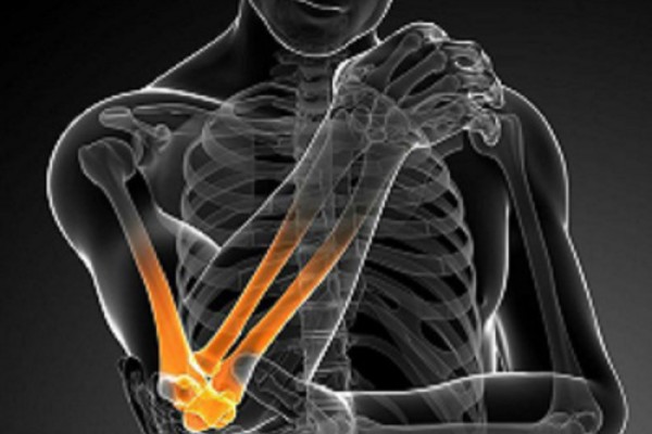 Golf Elbow
